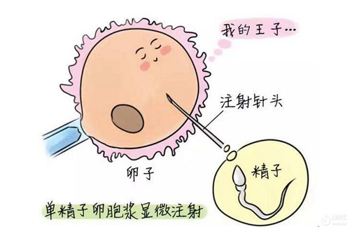 試管家庭趕緊看看：第四代試管什么時候開始的？